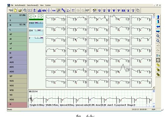 心電図ホルターcontectwelveチャネルデバイス/ekgシステム仕入れ・メーカー・工場