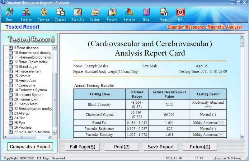 newest 39 reports Quantum magnetic body health resonance analyzer