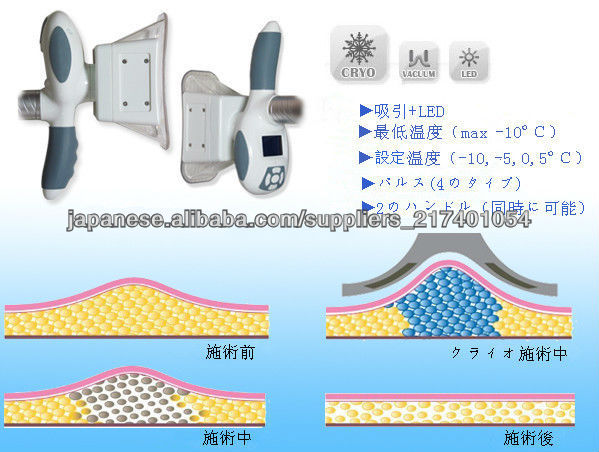 総合一体痩身機脂肪冷却+PDT+キャビテーション+RF問屋・仕入れ・卸・卸売り