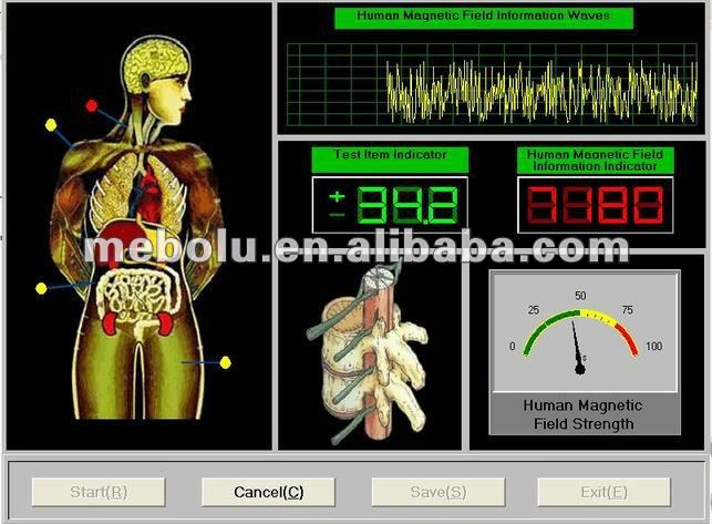 2012小型Analizador Cuantico De Bioreso<em></em>nancia Magnetica T-0309問屋・仕入れ・卸・卸売り