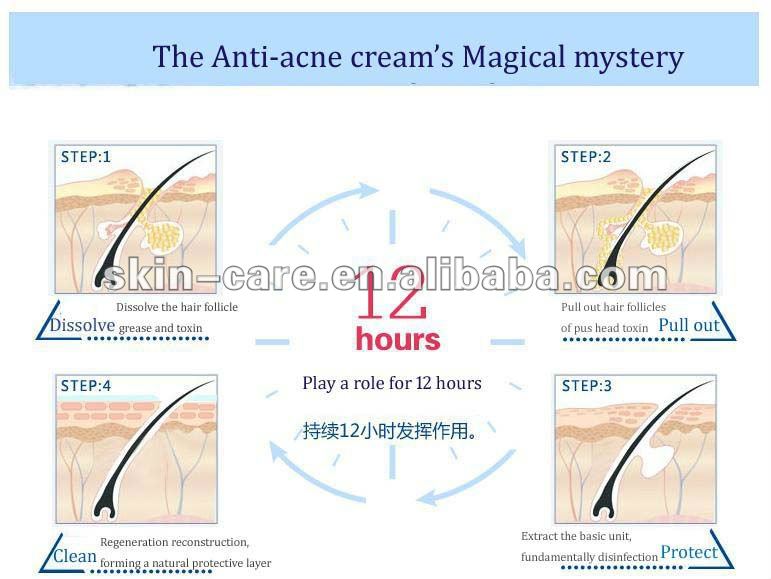 Hot selling 2012 Gold Aloe acne removal cream,China Lulanjina price
