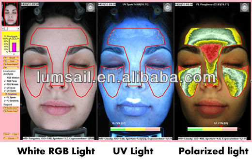 メガピクセル153dプロフェッショナルマジックミラー顔の皮膚24ヶ月保証で試験機問屋・仕入れ・卸・卸売り
