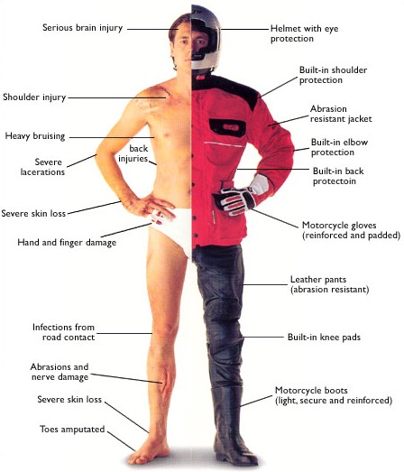 motorcycle-injuries.jpg
