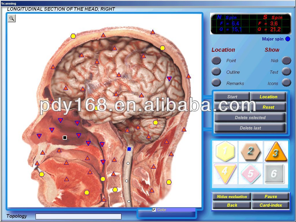 Newest 3d cell nls health analyzer 3d Bio Quantum analyzer 3d-cell 5d nls health analyzer with original software