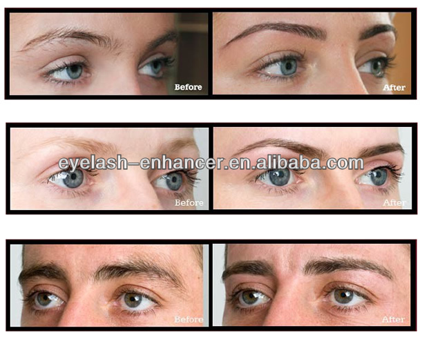 Eyebrow Growth Serum Best Brands, Anastasia, Before and After