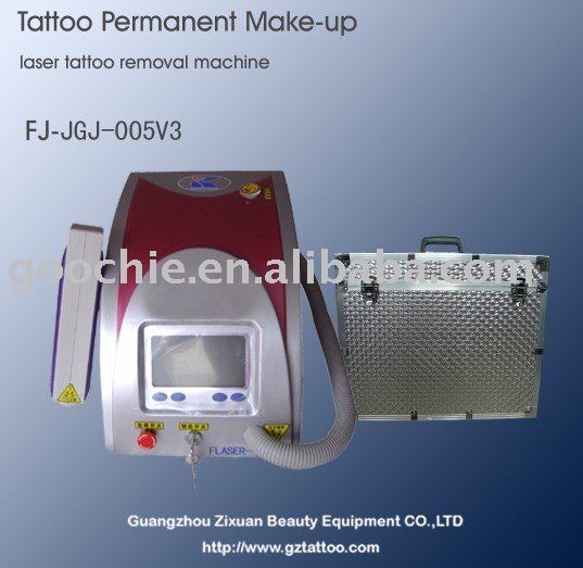 Tattoo Ink Removal. Tattoo ink removal equipment