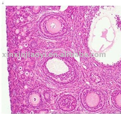 Ovary Section