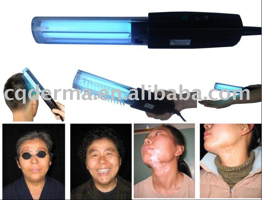 Uv Light Therapy Lamp For Psoriasis,Vitiligo,Eczema,Atopic ...