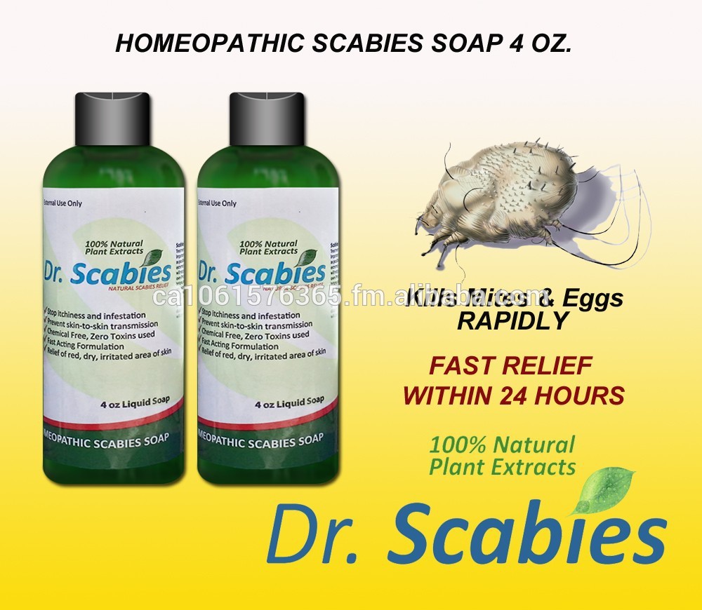 Where can you buy over-the-counter scabies medication?