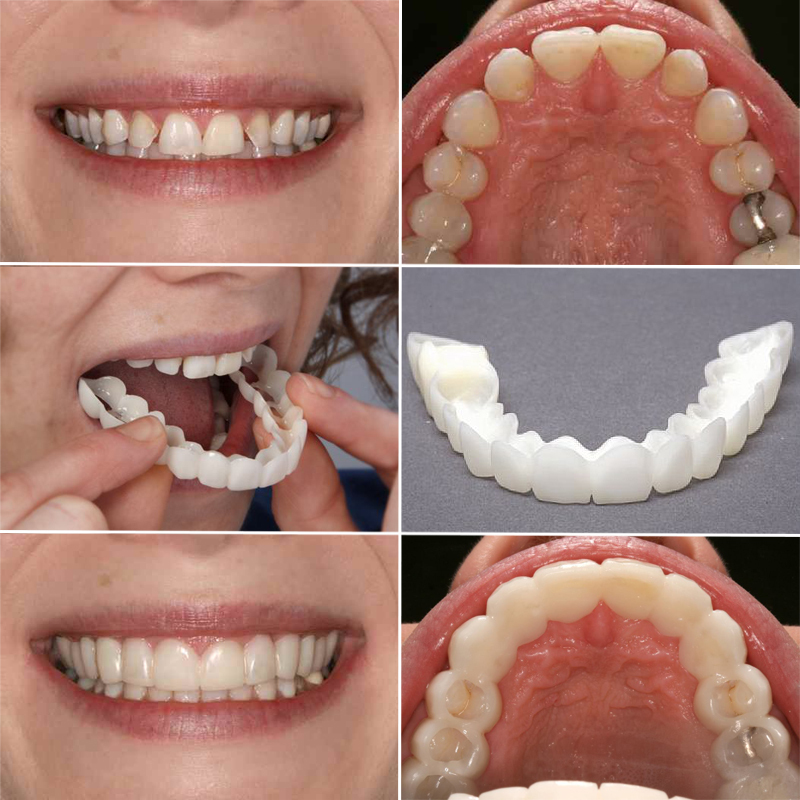 Which Teeth Whitening Toothpaste Is Best