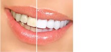 Free Shipping Cool Professional Tooth Whitening Pen Dazzling White Instant Teeth Remove Stains