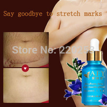 Free shipping wholesale AFY women postpartum recovery remove Stretch Marks,obesity marks SPA Massage essential oil 30ml,dsmv