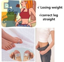1 pair foot ring strong stovepipe correct O type leg health monitors slim patch slimming health care FEET CARE M56-JT