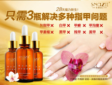 Best Quality Fungal Nail Treatment Essence Nail and Foot Whitening Toe Nail Fungus Removal Feet Care