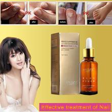 Fungal recover health to Nail onychomycosis Treatment Herbaceous energy Essence Foot Whitening Fungus Removal Care Gel