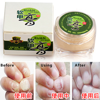 6g Fungal Nail Treatment Toe Fungus Gel Nail Soft Onychomycosis Cuticle Oil Nail For Fungus Nails