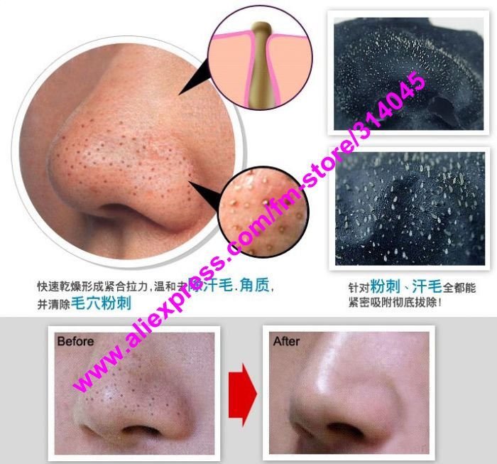 blackhead masker pilaten