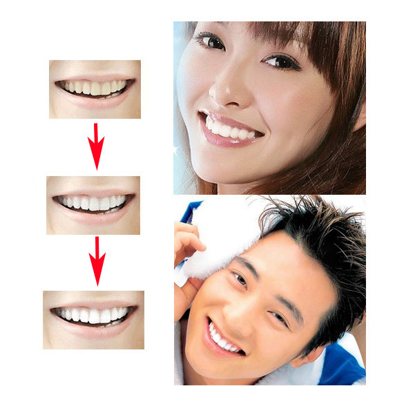 Super Practical Whiten Teeth Tooth Dental Peeling Stick Eraser 25PCS gib