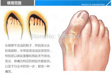 2pair Free shippingNew Hotsale Beetle crusher Bone Ectropion Toes outer Appliance Professional Technology Health Care Products
