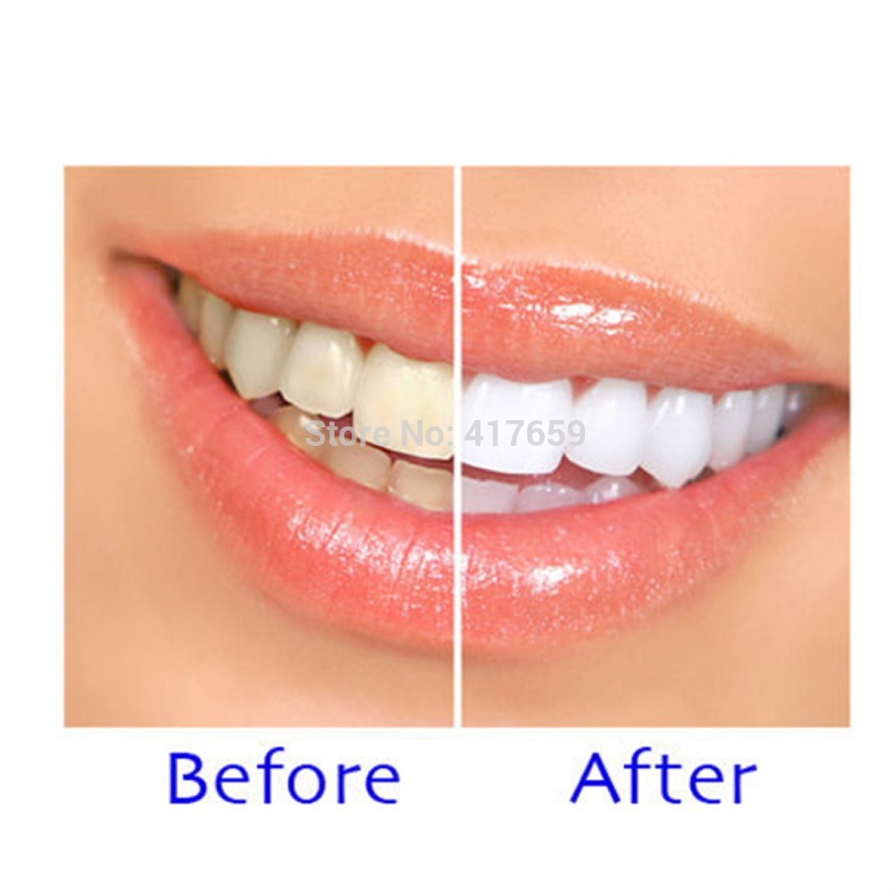 New ArrivalWhitening Gel carbamide peroxide Free Shipping Fast Delivery Teeth with syringe tips mint flavor