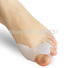 Bunions Hard Skin