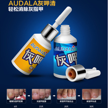 [ Buy two get one ] Liangjiashan onychomycosis A special liquid soft cream seven days of genuine free mail gray A clear 30ML