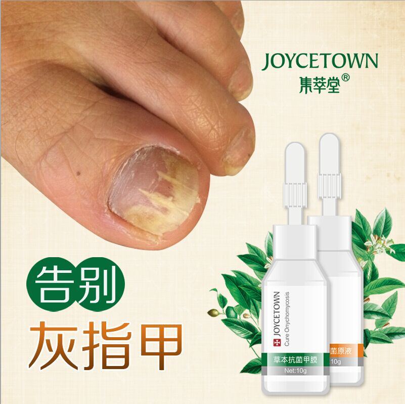 Fungal Nail Treatment Essence Nail Whitening feet care foot Antifungal Fungal Lotion Toe Finger Nail Art